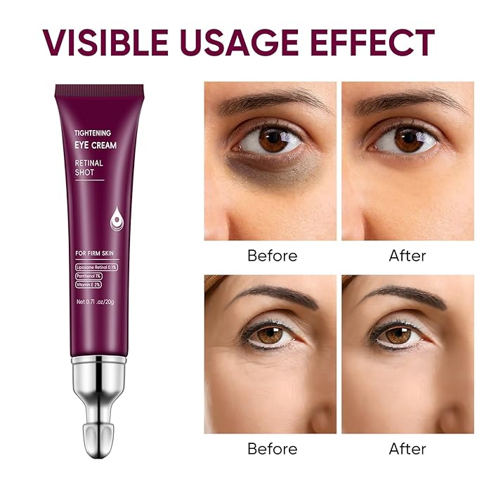 Eye Cream Stick, Retinol Eye Cream for Dark Circles, Vitamin E Hyaluronic Acid for Puffiness Anti Aging, Anti-Wrinkle Firming, Hydrating & Revitalizing Eye Creams for Men & Women