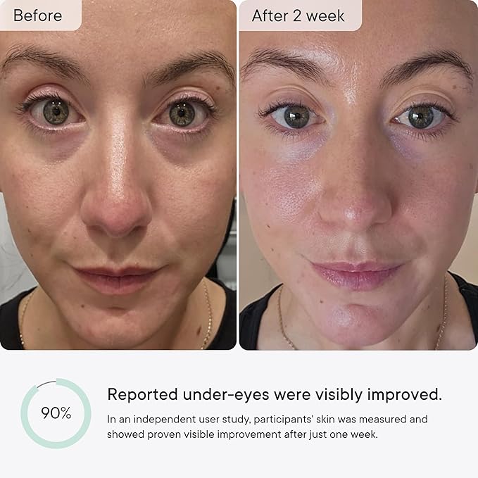 Qure Micro-Infusion Anti Wrinkle Patches for Smile Line, Frown lines, Under Eye Bags, Puffiness, Crow's Feet - Retinol, Caffeine - Dissolvable for Overnight Use - 8 Pairs