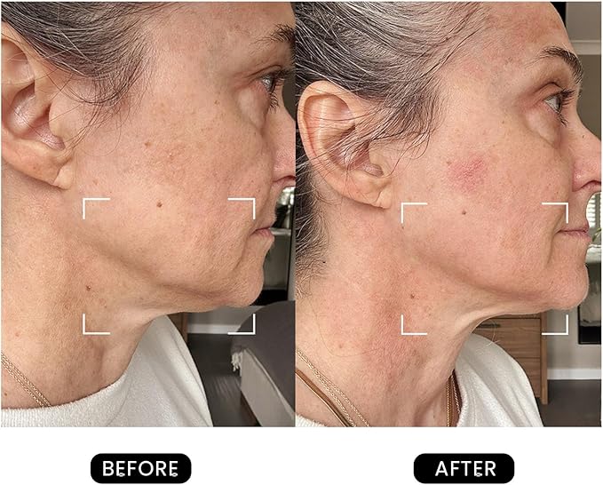 DermRays Revive Skincare for Anti-Aging, Glow Like Never Before,Multifunctional Beauty Device, Facial Massager for Home Use