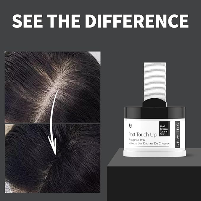 Hairline Powder 24H Stain-Proof, Root Touch Up Hair Color for Gray Coverage,Bald Spot Concealing Hair Shadow Powder for Women & Men,Natural-Looking (Medium Brown)