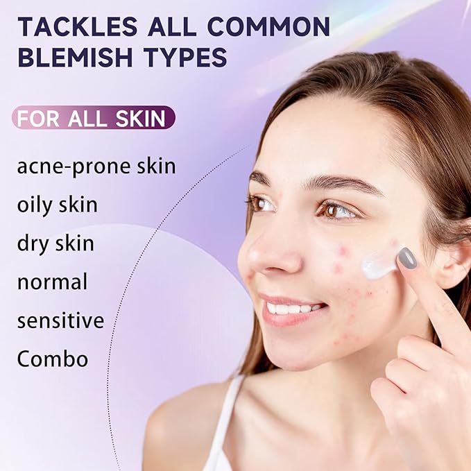 Cystic Acne Treatment for Face – Hormonal Acne Spot Treatment Pimple Cream with Azelaic Acid | Redness Reducing Acne Moisturizer for Rosacea & Sensitive, Acne-Prone Skin | Teens & Adults, 1.7 oz