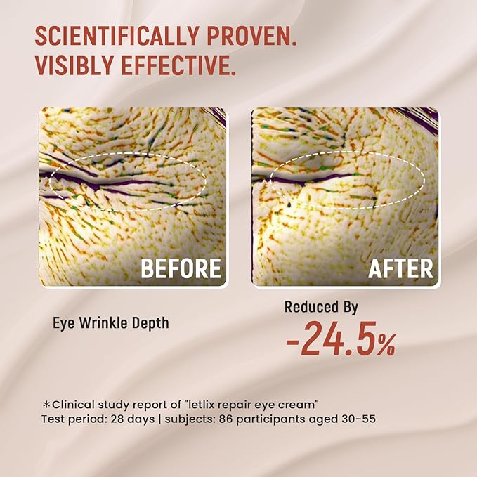 Retinol Eye Cream for Dark Circles and Puffiness - Advanced Peptide Eye Cream with Ginseng Ferment & Acetyl Hexapeptide-8 - Anti Aging Under Eye Cream for Wrinkles, Fine Lines & Crow's Feet - 0.68oz