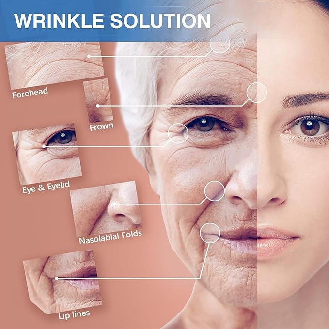 Facial Patches - Wrinkle Patches - Wrinkle Tape - Face Lifting Tape - Non-Invasive Wrinkle Remover - Multifunctional High Elasticity Wrinkle Forehead Eyes Face (Beige-2.5cm)