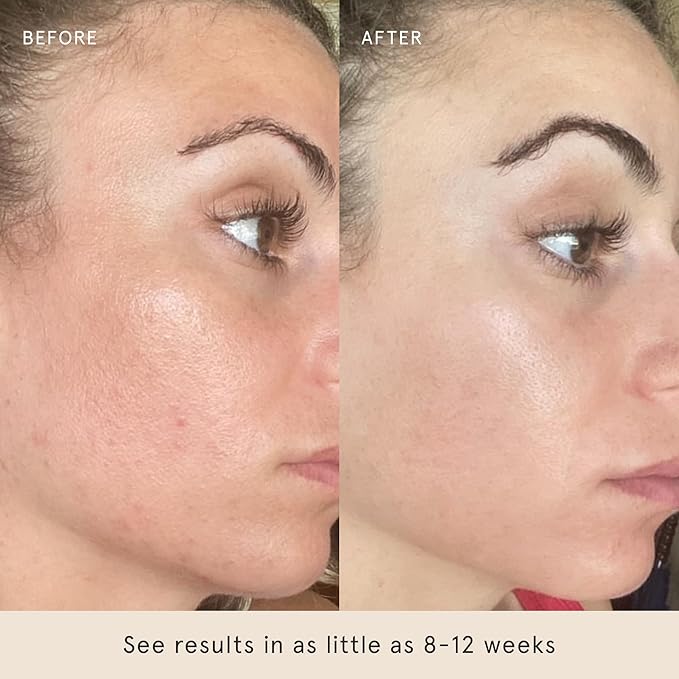 Barefaced Skin Brightening Trio - Toning Pads, Liquid Gold & Overachiever - Improve Skin Texture, Brighten Skin, and