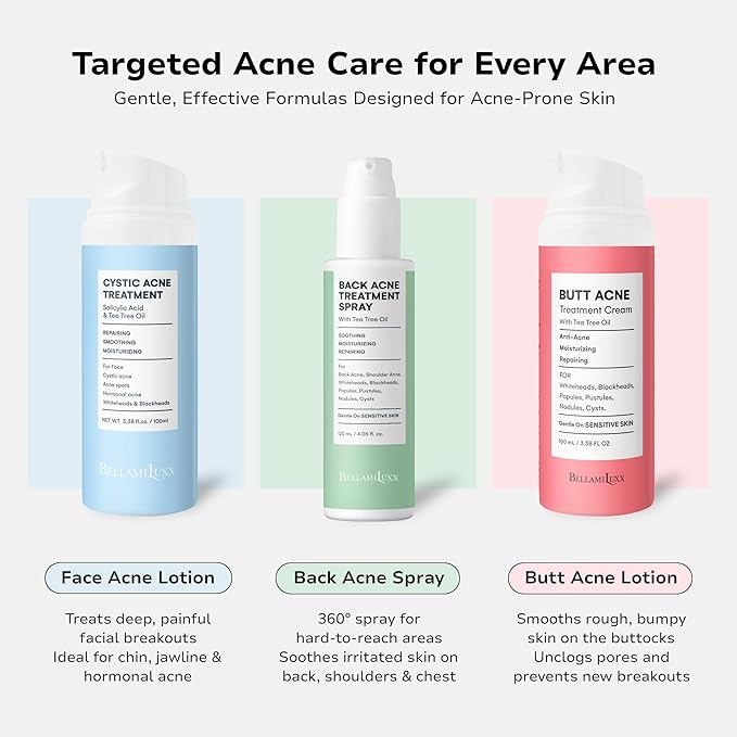 BellamiLuxx Body Acne Care Set: Butt Acne Treatment Lotion + Back & Body Acne Spray with 2% Salicylic Acid & Tea Tree Oil – Clears Breakouts, Soothes Redness & Prevents Bacne for Men, Women & Teens