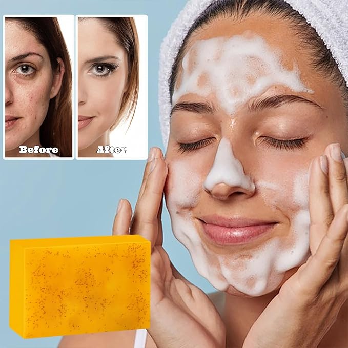 Turmeric Soap for Spots Remover, Honey Glow Lemon Turmeric Kojic Soap Bar for Face and Body, Natural Handmade Tumeric Soap Smooth Skin, Deep Cleansing for Men & Women