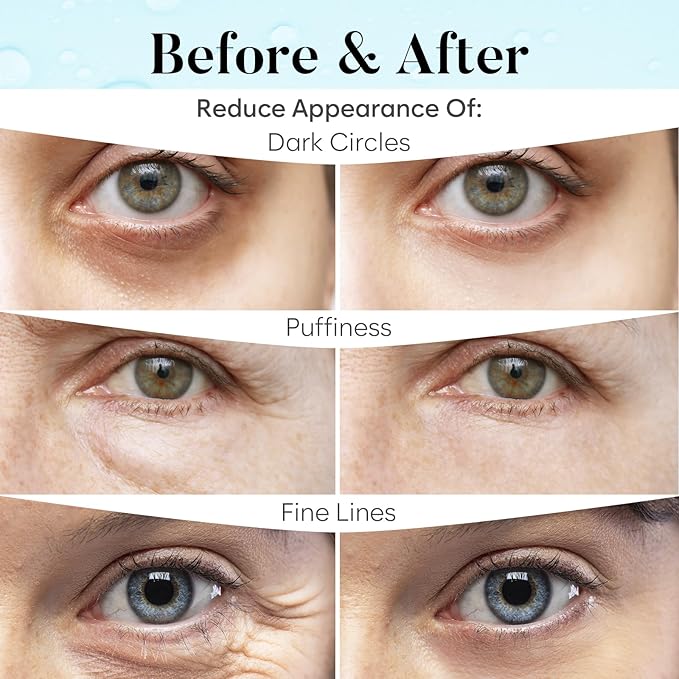 AURAE Retinol & Collagen Under Eye Patches (30 Pairs), Under Eye Mask for Puffy Eyes, Appearance of Dark Circles, Smoothing & Hydration, Self Care & Skincare Gifts for Women, Patch Yeux