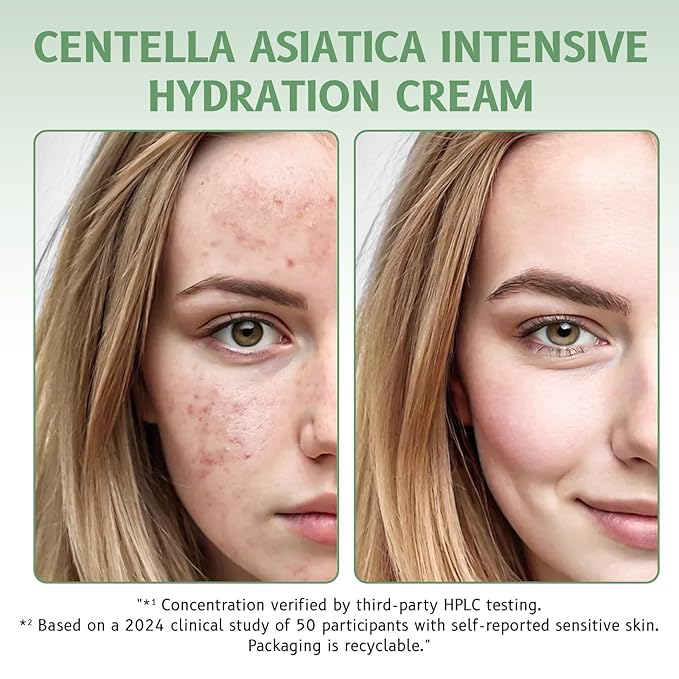 Lucksun Centella Asiatica Cream for Sensitive Skin, 85% Natural Moisturizer, Intensive Hydration & Repair, 50g