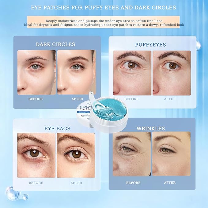 Under Eye Patches Masks-60 PCs for Dark Circles, Puffy Eyes, Fine Lines, Wrinkles, Eye Bags Treatment with Collagen & Hyaluronic Acid - Day & Night Skin Treatment Pads,Moisturizing and Hydrating