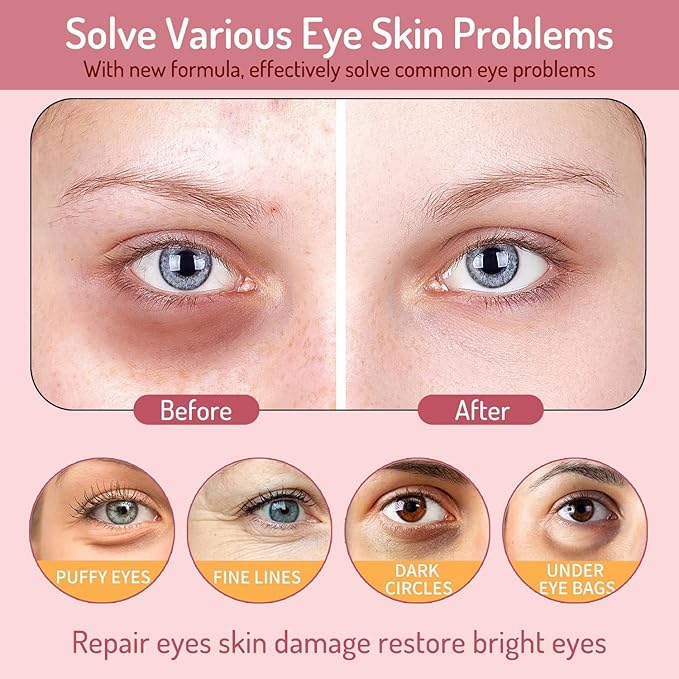 AOAO Revitalizing Niacinamide & Vitamin C Eye Masks, Brightening & Anti-Dark Circles, with Alpha-Arbutin & Hyaluronic Acid, Dark Circle Corrector, Pink Hydrating Under Eye Patches, 60 Pcs