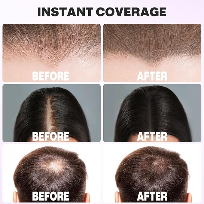 Acomler Instantly Root Cover Up Hairline Powder, Root Touch Up Hair Color 0.35 Ounce,Concealing Hair Loss for Thinning Hair, Hair Powder for Women Men with Bald Spots,Eyebrows,Beard Line (Dark Brown)