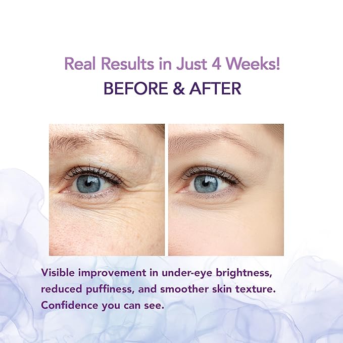 Caffeine Eye Cream- Under Eye Brightener Retinol Eye Cream For Dark Circles Puffiness Wrinkles- puffy eyes treatment for women (15g)