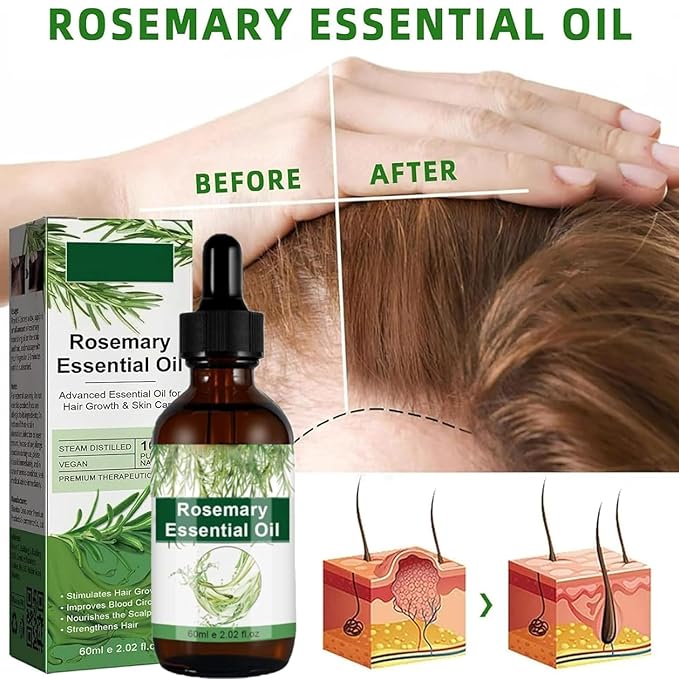 Aceite de Romero para Crecimiento y Tratamiento Capilar, Gotero para Estimular el Crecimiento del Cabello y Prevenir la Caída, 60ML/2.2 Fl Oz (2 Unidades)