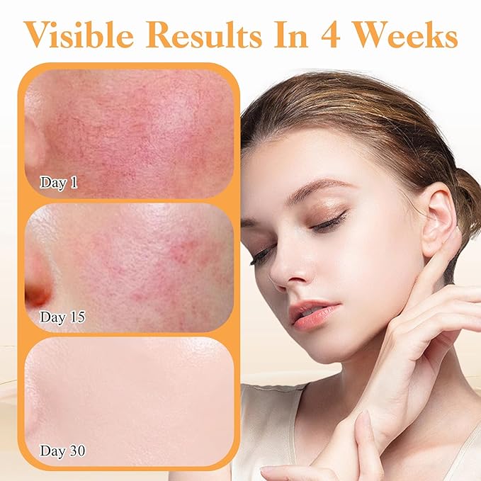 Turmeric Kojic Acid Soap for Dark Spots with Turmeric, Vitamin C & Shea Butter, Brightening Face & Body Wash, Even Tone Skin Cleanser for Hyperpigmentation & Inner Thighs, 2 Pack