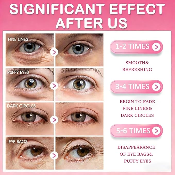 Lingyun 30 Pairs Eye Masks & Lip Mask,Under Eye Patches for Puffy Eyes,Pink Collagen Eye Mask Pads,Anti Wrinkle Patches for Lip, Mothers Day Gifts,Bulk Gifts, Teacher Appreciation Gifts, Small Gifts