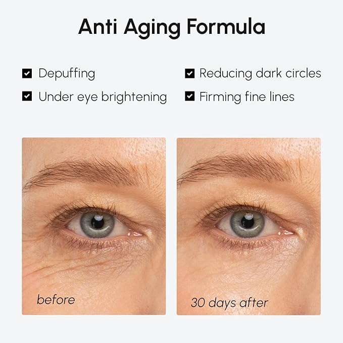 MAREE Under Eye Balm Stick Hydrating – Retinol Caffeine Under Eye Brightener Stick for Older Women – Collagen Undereye Cream for Dark Circles & Wrinkles – Skin Care Treatment Moisturizer