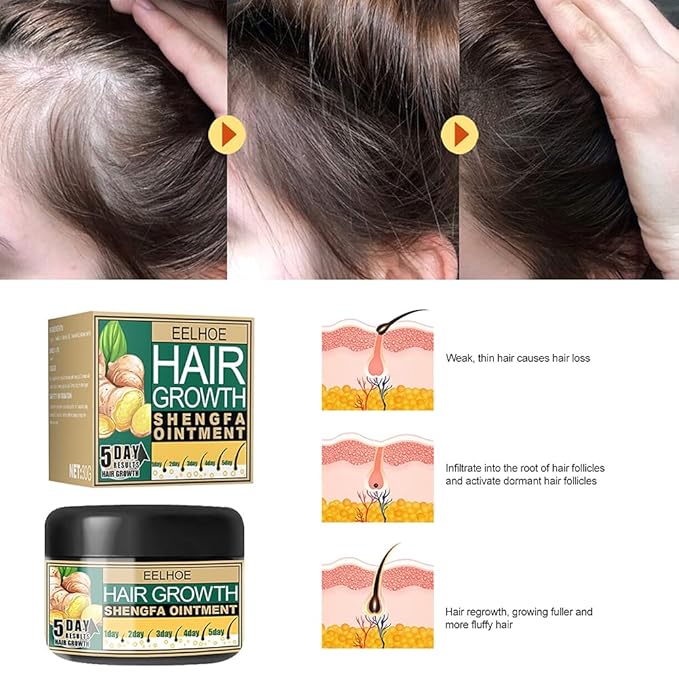 Ginger Hair Growth Cream, Germinal Conditioner, Regrowth Serum - Unisex, For Hair Loss and Thinning(30g/1 OZ sample)