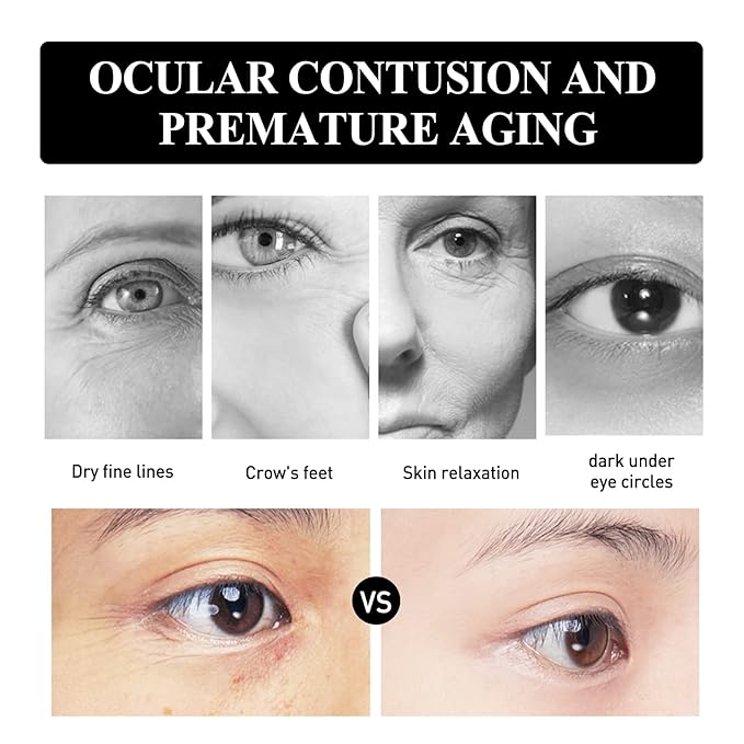 Snake Peptide Eye Cream，Anti-Aging Eye Cream for Dark Circles, Puffiness & Wrinkles, Hydrating Eye Treatment with Niacinamide & Glycerin (1)