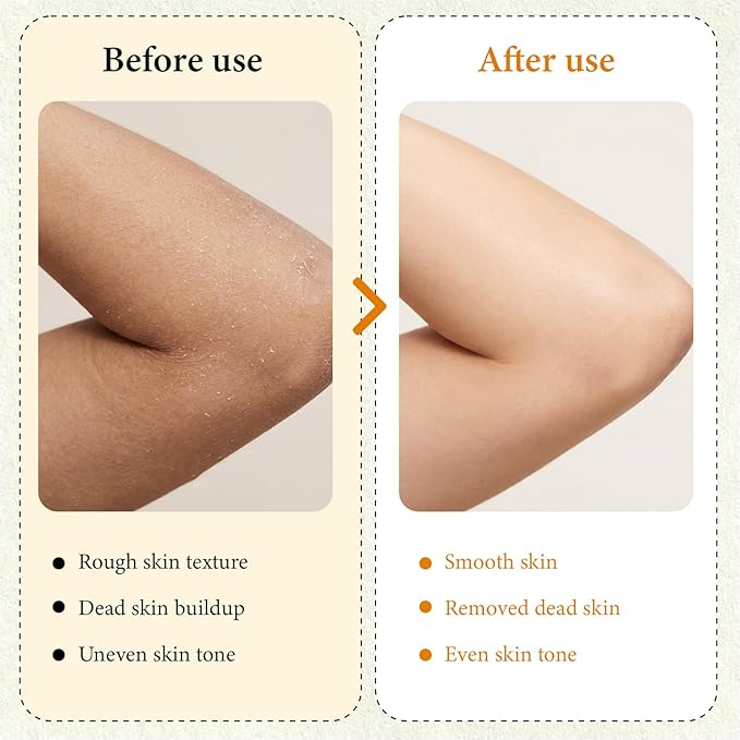 Kojic Acid Turmeric Spray with Sponge, Exfoliating Body Spray with Retinol, Glutathione, Niacinamide, Gentle Exfoliation for All Skin Types, Nourish Skin, Turmeric Peel Shot, 100ml