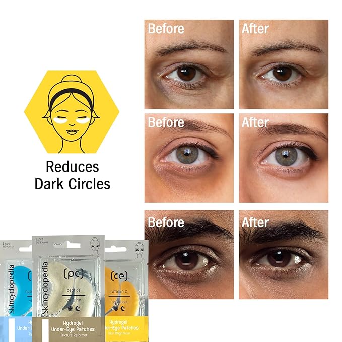 Under Eye Treatment, Roll-On + 3 Hydrogel Pads with Caffeine & Q10, Cooling Roller, Energizing Serum for Dark Circles, Puffiness Bags, Fine Lines & Wrinkles, Deep Hydration Activator.