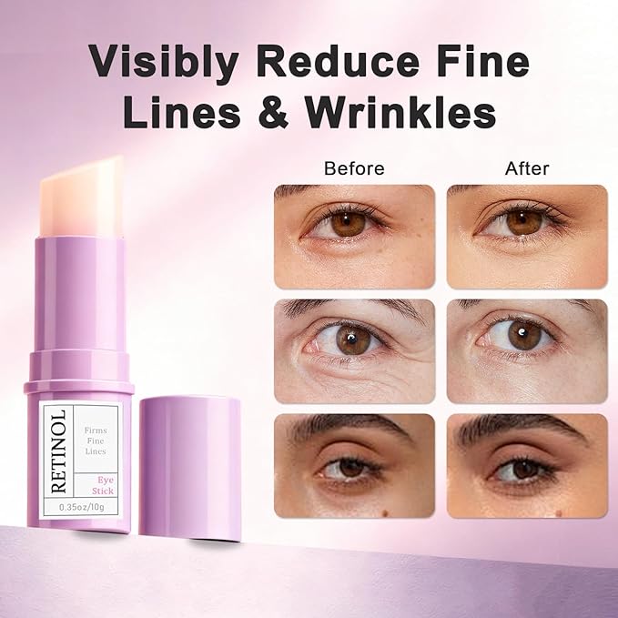 Retinol Eye Stick with Hyaluronic Acid & Collagen - Under Eye Cream for Dark Circles, Puffiness and Wrinkles, Anti-Aging Formula to Reduces Fine Lines, Portable & Gentle Formula, 0.35oz