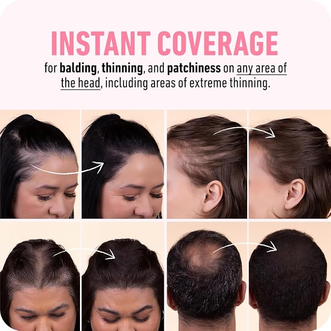 BOLDIFY Hairline Powder (LARGE, 10g) - Root Touch Up Hair Color for Gray Coverage - Bald Spot Concealing Hair Powder for Women & Men - 24-Hour Stain-Proof - Dark Auburn