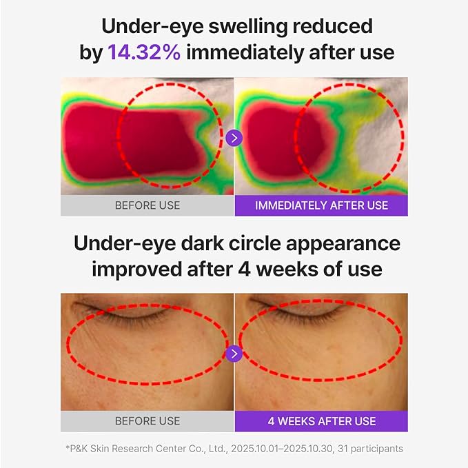 CENTELLIAN 24 360 Shot PDRN Glowing Eye Patch (6ea, 3 pairs) – Instant Depuffing & Dark Circle Revitalizing Hydrogel Under Eye Patches with PDRN, Retinol & Glutathione, Cooling Eye Bags Treatment