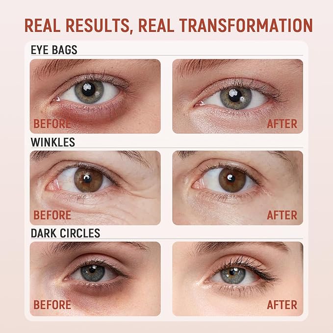 Retinol Eye Cream for Dark Circles and Puffiness - Advanced Peptide Eye Cream with Ginseng Ferment & Acetyl Hexapeptide-8 - Anti Aging Under Eye Cream for Wrinkles, Fine Lines & Crow's Feet - 0.68oz