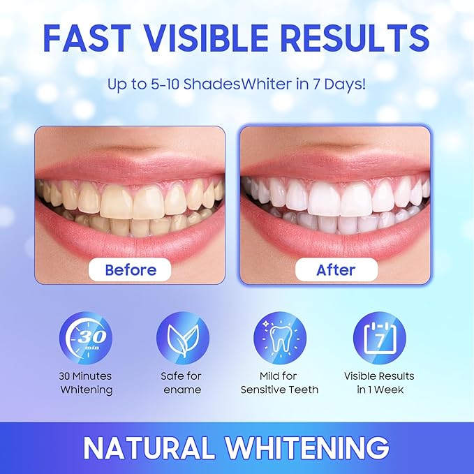 luanerl Teeth Whitening Strips 56 Strips - 28 Treatments,Peroxide & Sensitivity Free,Enamel Safe with Soothing Natural Ingredients for Deep Stains Removal