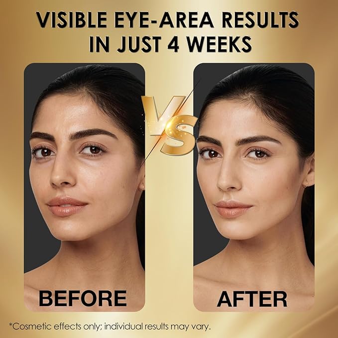 Eye Serum for Dark Circles and Puffiness - Advanced Anti-Aging Under Eye Care for Wrinkles, Bags and Fine Lines - Hydrating and Firming Formula to Brighten and Revitalize Tired Eyes 1 Fl.oz.
