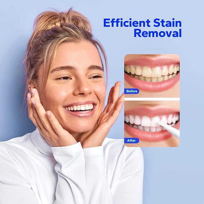 SmileShark Premium Teeth Whitening Pens (4 Count), Sensitive-Free Whitening Gel, Professional-Strength Formula, On-The-Go Tooth Gel for Adults