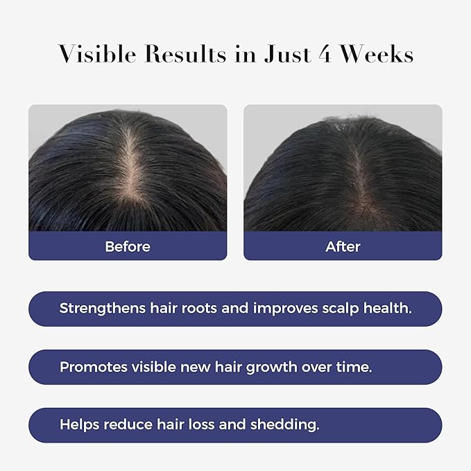Hair Growth Serum Roll On,3% Rosemary, 6% Batana oil,3% Redensyl & 2% Anagain| No-Rinse, Fast-Absorbing | For Thinning Hair & All Hair Men & Women (2 Pcs)