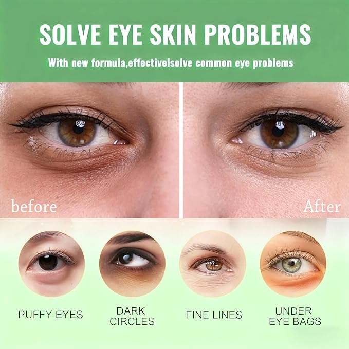 firstfly Under Eye Patches - 60 PCS Aloe Vera Eye Masks for Dark Circles and Puffiness, Hydrating Eye Mask Skincare, Stocking Stuffers, Eye Patches for Women Reduce Wrinkles and Fine Lines