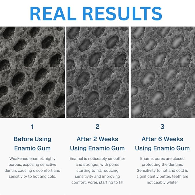 Enamio Mint Remineralizing Gum with Nano Hydroxyapatite for Enamel Support & Sensitive Teeth - Xylitol Gum, Plastic Free, Sugar Free, Natural Oral Care - No Aspartame- Made in USA - 4 Pack