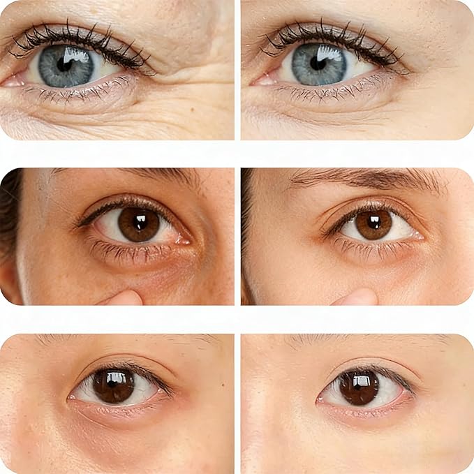 Eye Pods for Under Eyes Bags, Eyes Lift Instant Cream, Red Light Therapy Eyes Pads Patches for Dark (1 PC Eye Pods)