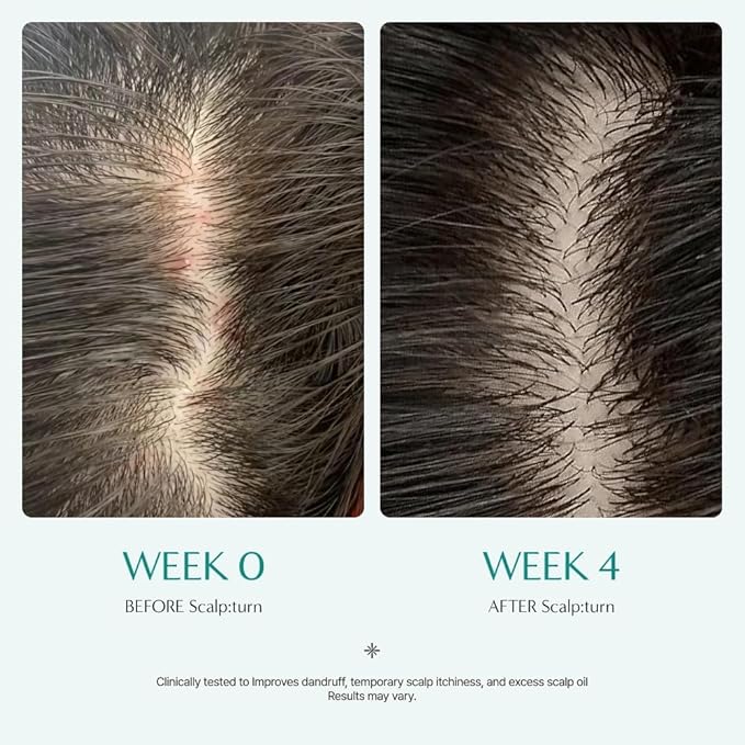 lilyeve SCALPTURN Cica PDRN Scalp Serum with Built-in Brush, PDRN to Strengthen Hair Roots, Itchy Scalp Relief, Dry Scalp Hydration - Korean Hair Care, 3.38 fl.oz (Pack of 3)