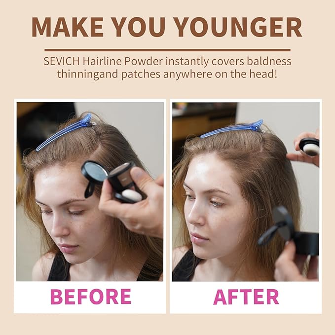 Sevich Hairline Powder: Instantly Conceals Hair Loss and Gray Roots, Grey Windproof & Sweatproof Hair Toppers for Women & Men