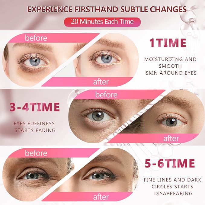 Pink Eye Mask 60Pcs, 5 Portable 24K Gold Collagen Under Eye Patches, 30 Pairs Hydrating Undereye Gel Pads for Women Men Dark Circles Puffy Eyes Puffiness Wrinkle Eye Bag Treatment