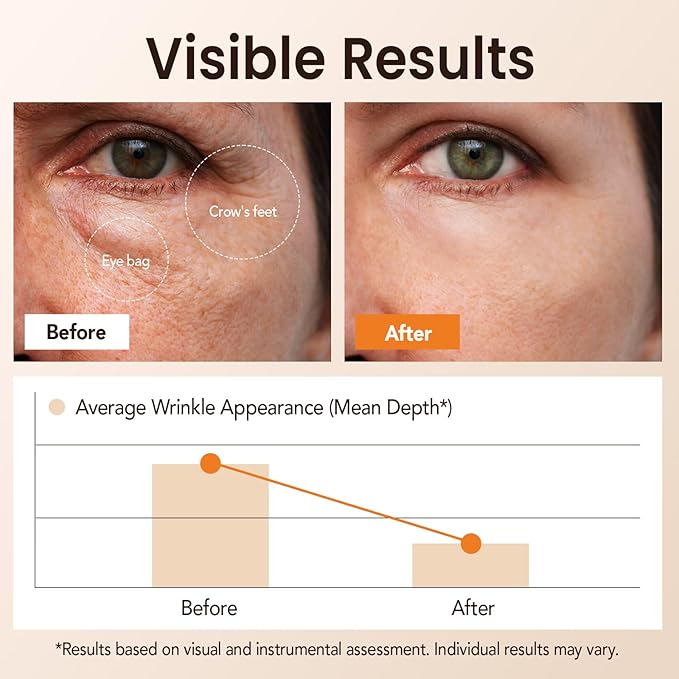 Instant Eye Tightener Cream, Temporary Eye Firming Cream, Fine Lines & Dark Circles, Beauty of Eye Serum Skin Care for Women and Men, periocular Skin care for All Skin Types 20 mL/0.67 fl oz