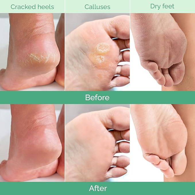 PLANTIFIQUE Foot Peeling Mask - Peeling Foot Mask Dermatologically Tested Repairs Heels & Removes Dry Dead Skin for Baby Soft Feet (Jasmine, 1 Count (Pack of 1))
