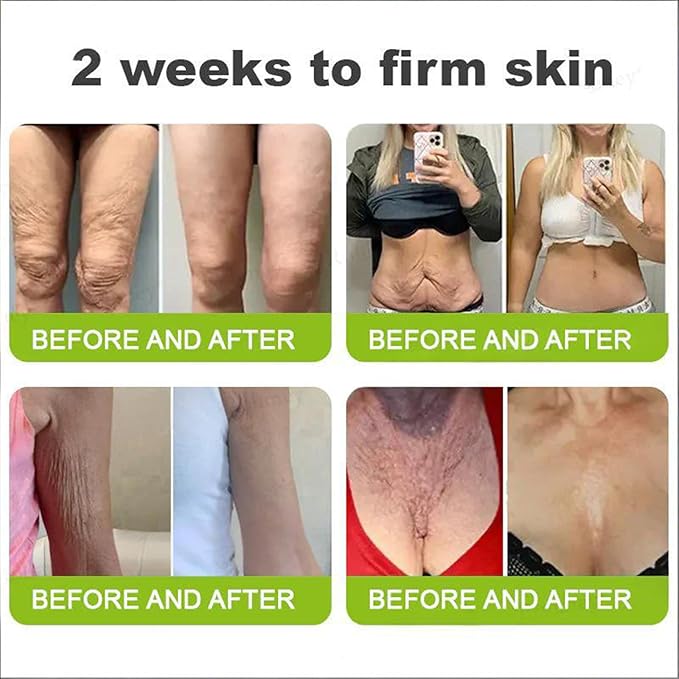 Rolimey Botoxmix & Vita-A Retinol Shot Wrinkle-Lift Tightening Cream, Vita A Retinal Shot Tightening Booster, Rolimey Anti Wrinkle cream - Pore Minimizer, Wrinkles & Fine Lines for All Skin (1PC)