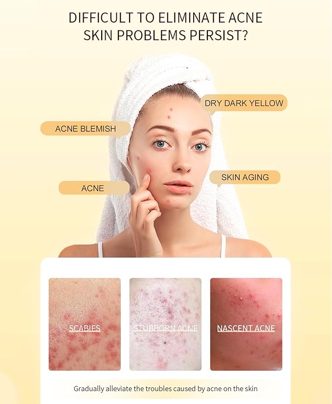 Propolis and Niacinamide Hydrating Facial Soothing Moisturizer, Glow Boosting Serum for Face for Acne-prone&Sensitive skin, Minimize breakouts, Korean skincare 30ml, 1 fl.oz