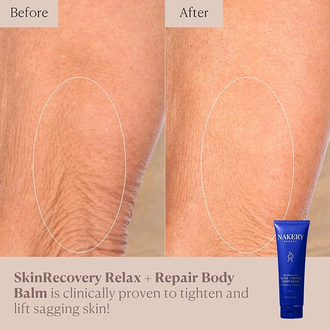 Nakery Beauty SkinRecovery Relax + Repair Body Balm, Magnesium Melatonin Sleep Lotion with Retinol + SepiLift, Firming Cream for Crepey Sagging Skin Overnight, Shea Butter, Lavender Chamomile, 250mL