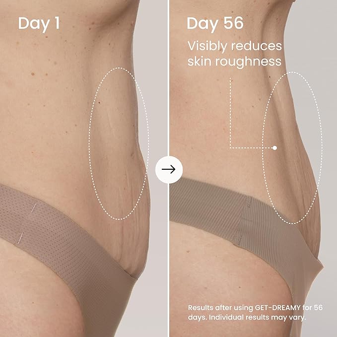 MAËLYS GET-DREAMY Overnight Toning Whip - Cellulite Cream & Skin Tightening Support with Milk Thistle + Uva-Ursi - Moisturizing Body Cream in a Whipped Texture (3 Pack)