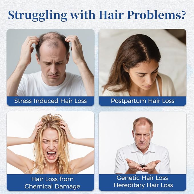 Hair Growth Serum Roll On with Rosemary，Helps Support Thicker, Fuller Hair Appearance，Clean, Non-Greasy Hair Loss Support for Men & Women，Rosemary，0.84 Fl Oz (Pack of 2)