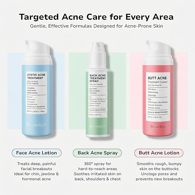 BellamiLuxx Fungal Acne Treatment Lotion: Helps with Bumps, Clusters, Itch & Redness – Lightweight Anti-Fungal Face & Body Moisturizer for Fungal Skin with Natural Actives & Soothing Plant Extracts