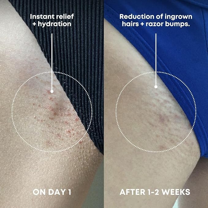 Bushbalm Ingrown Hair Exfoliating Scrub – Pre-Shave Sugar Scrub for Ingrown Hairs, Razor Bumps & Dry Skin – Gently Buffs & Soothes Sensitive Skin - Watermelon Sugar 236ml