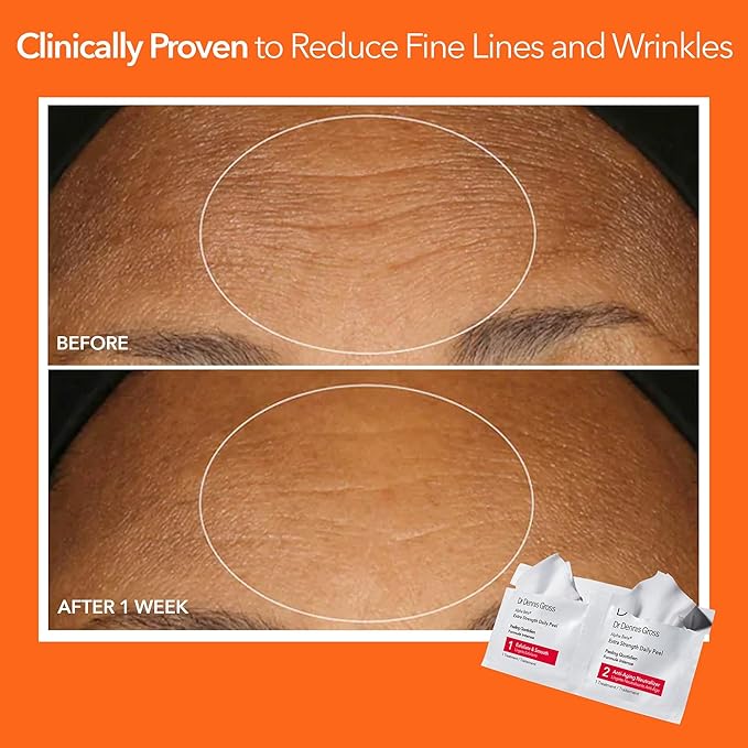 Dr. Dennis Gross Alpha Beta Extra Strength Daily Peel: for Oily Skin, Uneven Tone or Texture, Wrinkles or Enlarged Pores (30 Treatments)