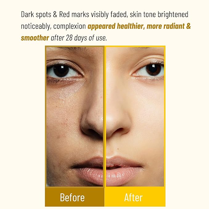 Cocoon Hung Yen Turmeric Face Mask for Dull Skin, Dark Spots, Blackheads, Skincare Facial Mask, Face Skincare Gift