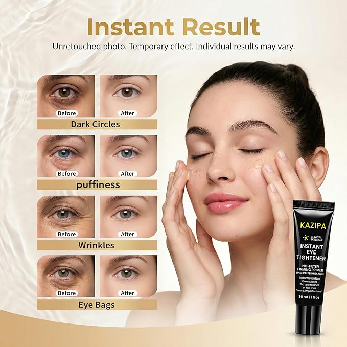 Instant Eye Tightener Cream, Temporary Under Eye Firming & Lifting Cream Anti Aging For Dark Circles,Wrinkles, Fine Lines, Undereye Bags Treatment And Puffiness Removal,1 Fl Oz